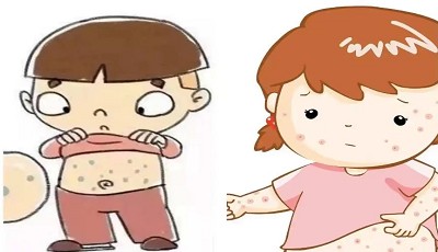 春季常见传染病的防与治