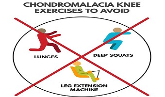 应对膝关节的“炎”重警告,康复医学专家给您支招!