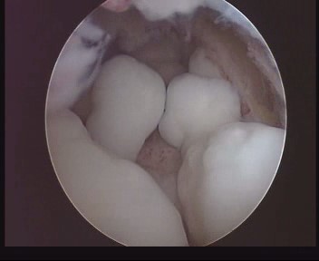 碗里的水果中度可信度描述已自动生成