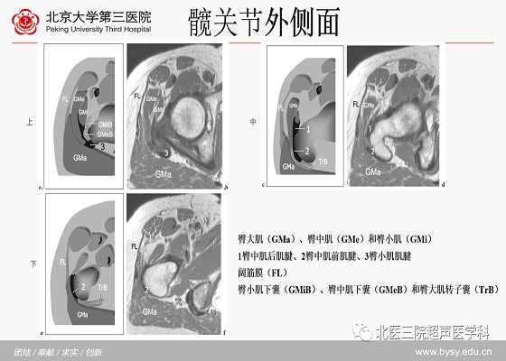 髋关节解剖（二）