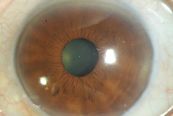 爱眼日特辑:后疫情时代之眼科六宗罪