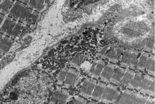 超微病理(电子显微镜)平台简介