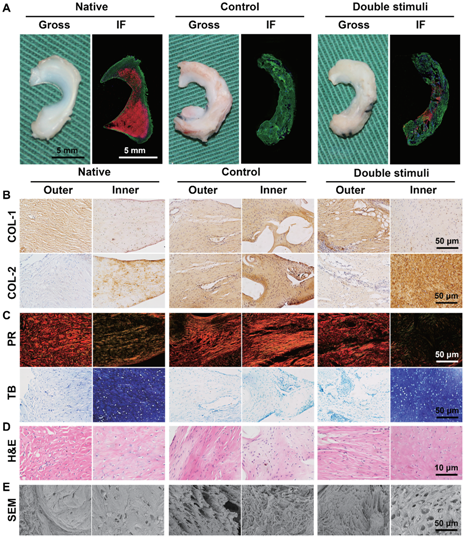 余家阔课题组在Science子刊发表组织工程半月板的最新研究成果