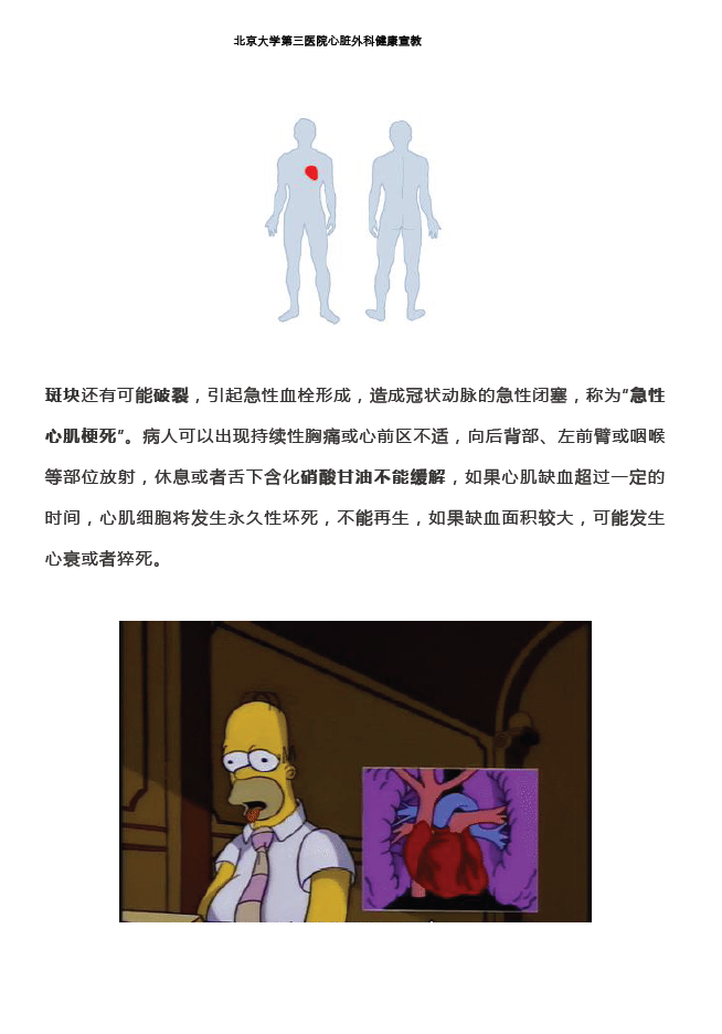 冠状动脉旁路移植术后患者关心的问题