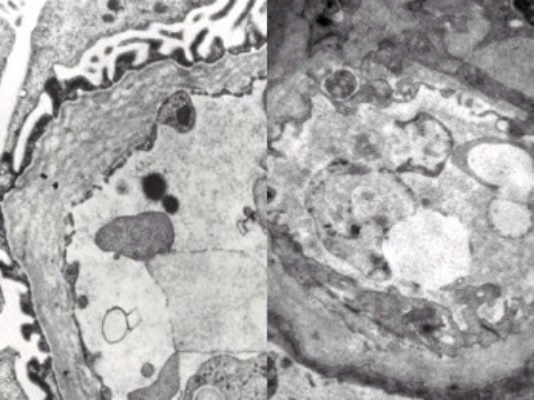 超微病理(电子显微镜)平台简介