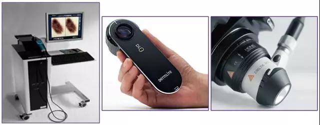 易伪装的早期皮肤癌与皮肤镜检查 | 担心额头那个“黑痣”有问题,她来到北医三院皮肤科……