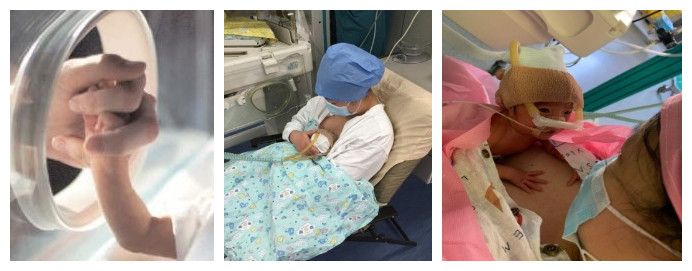 北京大学第三医院新生儿重症监护病房（NICU）