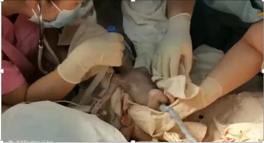 北京大学第三医院新生儿重症监护病房（NICU）