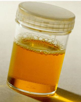 慢性肾脏病出院患者健康教育