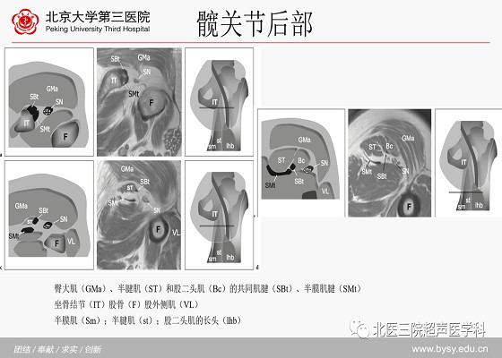 髋关节解剖（二）