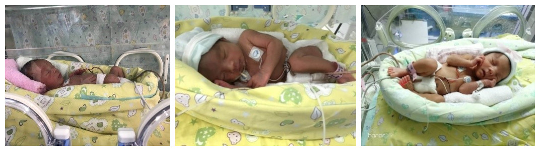 北京大学第三医院新生儿重症监护病房（NICU）