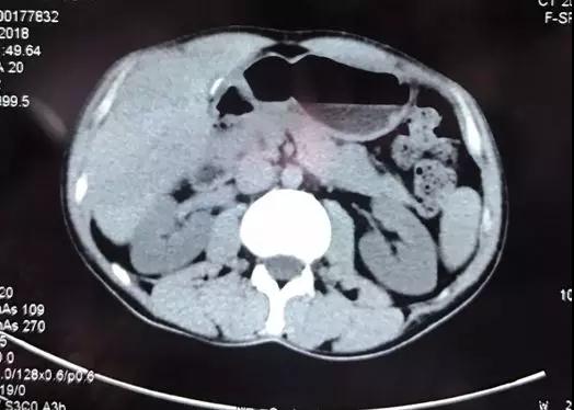 援藏后记 | 微信群牵线千里会诊,藏族小伙来京就医