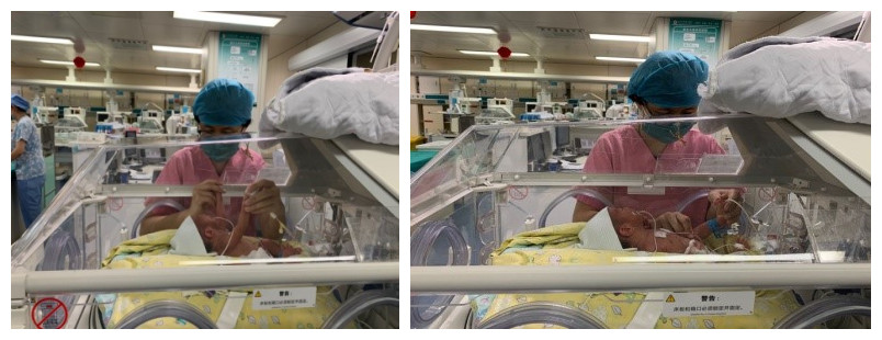 北京大学第三医院新生儿重症监护病房（NICU）