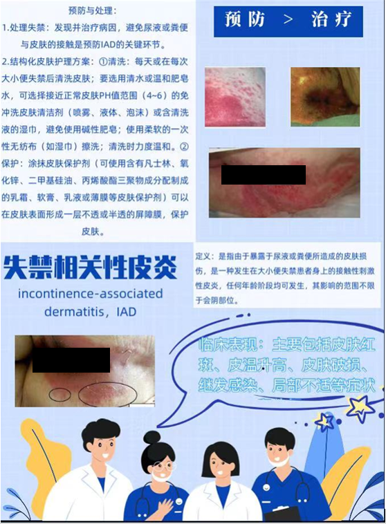 失禁性皮炎的护理