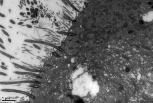 超微病理(电子显微镜)平台简介