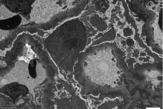 超微病理(电子显微镜)平台简介