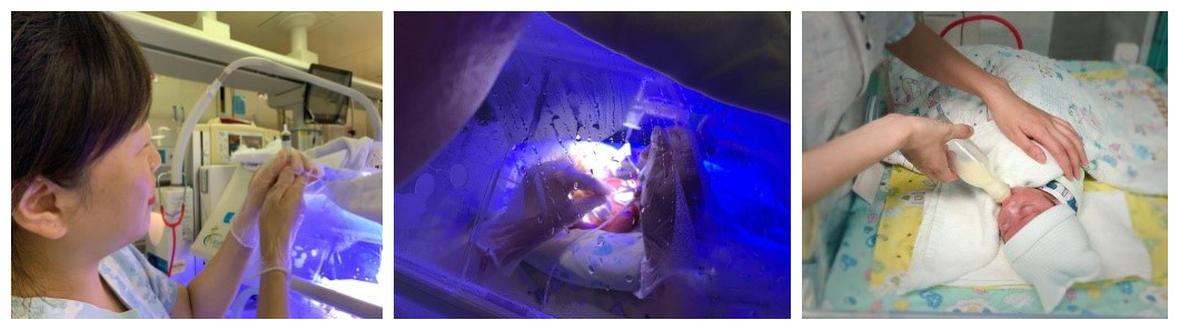 北京大学第三医院新生儿重症监护病房（NICU）