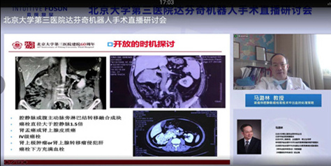 泌尿外科举办达芬奇机器人手术研讨会