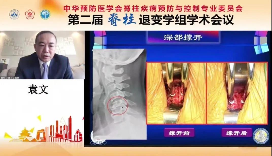 中华预防医学会脊柱疾病预防与控制专委会第二届脊柱退变学组学术会议圆满落幕！