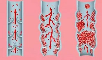 简单易行的微运动,助力您的健康!