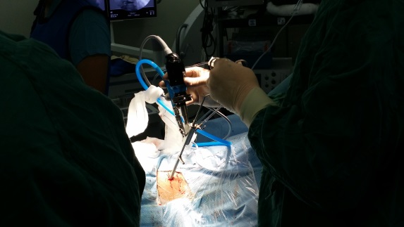 椎间孔镜(脊柱内镜)手术问与答