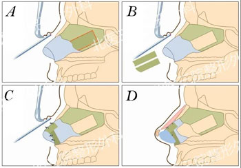成形科安阳医生获北医三院2020医疗技术创新一等奖