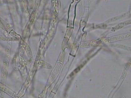 真菌检测的方法都有哪些?