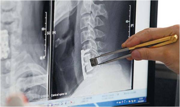 China Daily--Printed bones