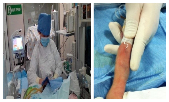 北京大学第三医院新生儿重症监护病房（NICU）