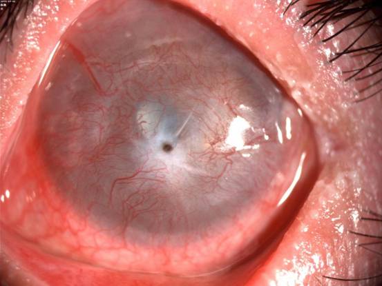 爱眼日特辑:后疫情时代之眼科六宗罪