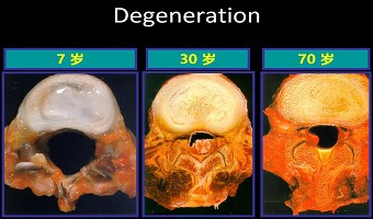如何拯救“低头族”的颈椎?专家给出终极方案