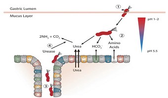终结幽门螺杆菌的一切疑问,专家帮您健康无“幽”