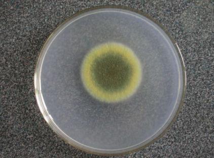 真菌检测的方法都有哪些?