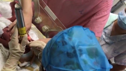 北京大学第三医院新生儿重症监护病房（NICU）