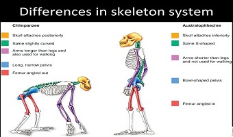 如何拯救“低头族”的颈椎?专家给出终极方案