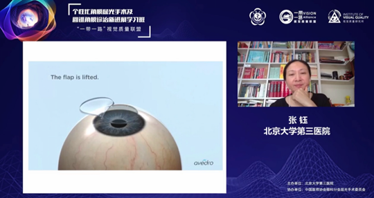 眼科举办个性化角膜屈光手术及圆锥角膜诊治新进展线上学习班