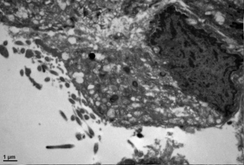 超微病理(电子显微镜)平台简介