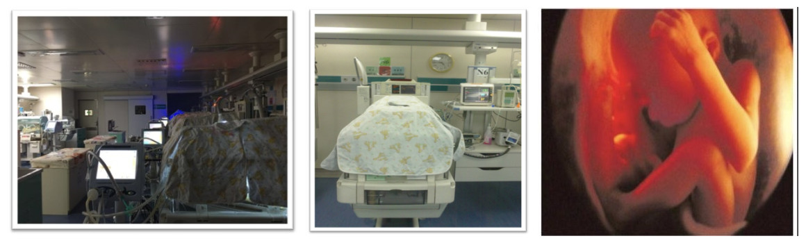 北京大学第三医院新生儿重症监护病房（NICU）