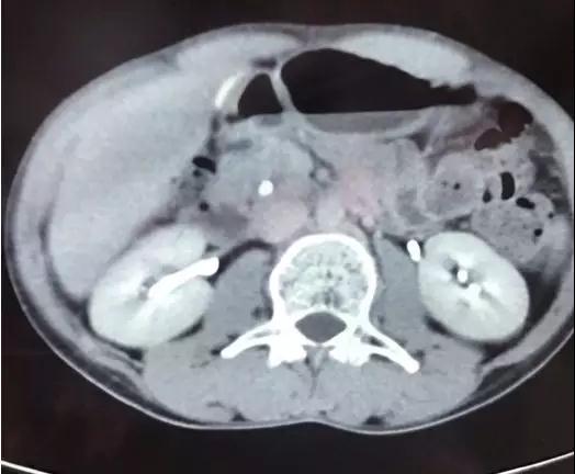 援藏后记 | 微信群牵线千里会诊,藏族小伙来京就医