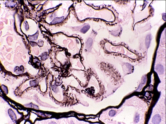 肾穿刺活检平台及开展项目