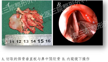 成形科安阳医生获北医三院2020医疗技术创新一等奖