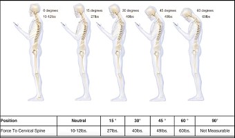 如何拯救“低头族”的颈椎?专家给出终极方案