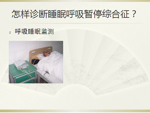 呼吸睡眠暂停综合征